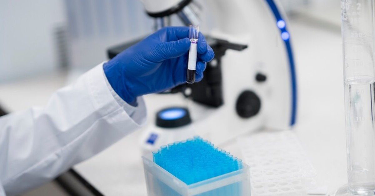 Best Pathology Lab in Indore