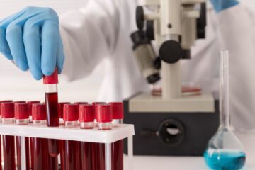 blood test lab in indore