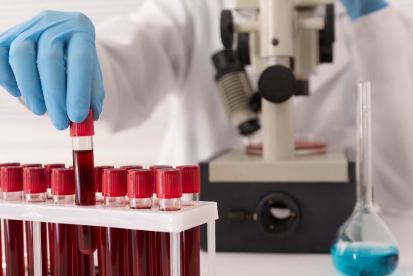blood test lab in indore