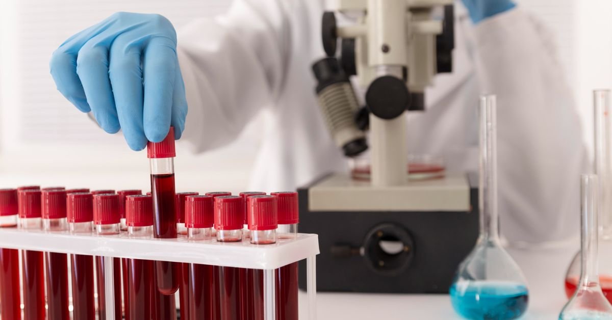 blood test lab in indore